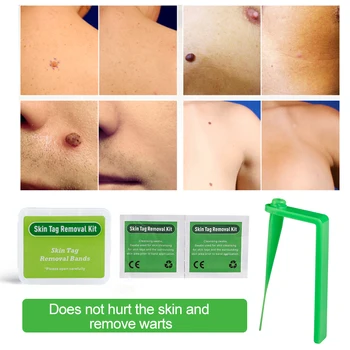 1Set Grön Hud Tag Remover Kit Version Micro Hemma Kroppen Effektivt Mullvad Vårta Remover Huden Tag hudvård C1886