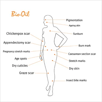 60ml Bio Oil Skin Care Ning bristningar Remover Kräm tar Bort Organ bristningar Ojämn hudton Purcellin Oil Orijinal